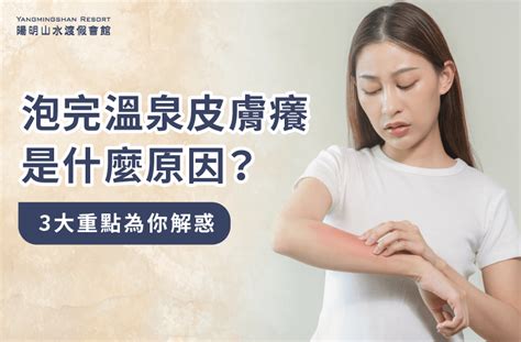 皮膚癢|常常皮膚癢怎麼辦：原因、處理重點指南大全